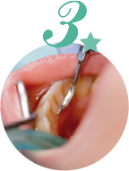予防歯科サロン爽　歯のクリーニングの流れ