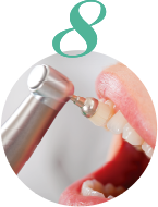 歯面の研磨